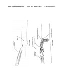 SYSTEM FOR TISSUE FIXATION TO BONE diagram and image