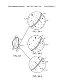 Graft Systems Having Semi-Permeable Filling Structures and Methods for     Their Use diagram and image