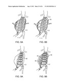 Graft Systems Having Semi-Permeable Filling Structures and Methods for     Their Use diagram and image