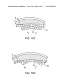 Graft Systems Having Semi-Permeable Filling Structures and Methods for     Their Use diagram and image