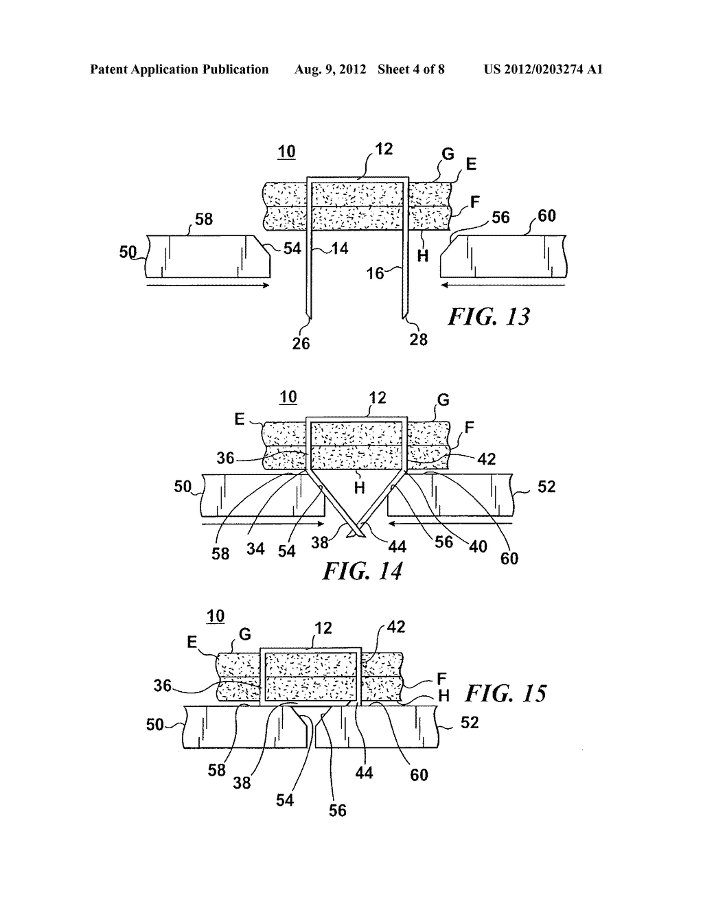 STAPLE FOR USE IN SURGICAL PROCEDURES - diagram, schematic, and image 05