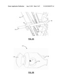 SYSTEMS AND METHODS FOR CORRECTING SPINAL DEFORMITIES diagram and image