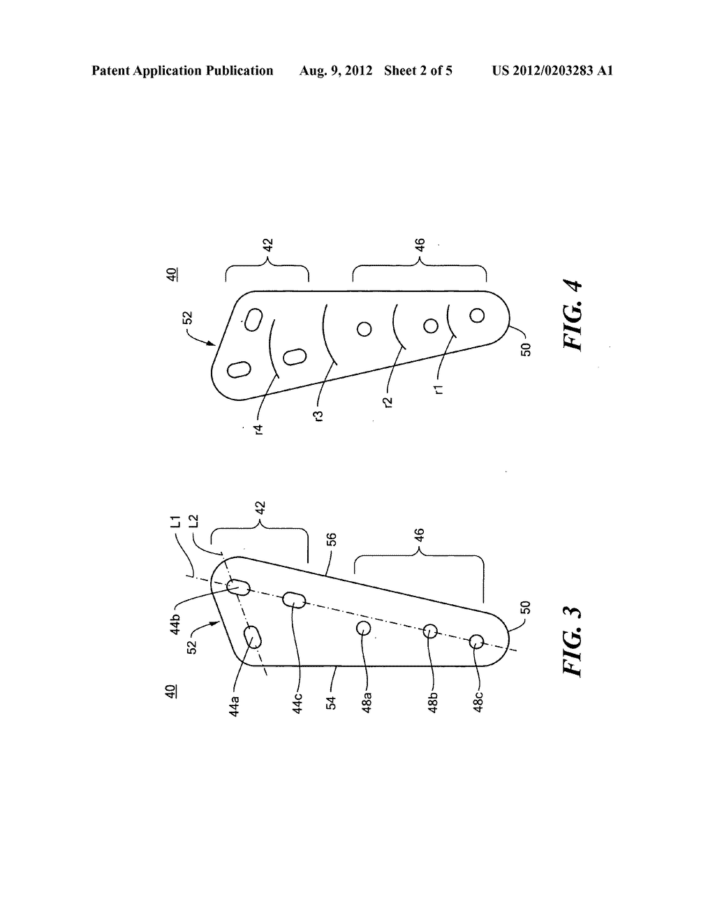 Fixation plate - diagram, schematic, and image 03