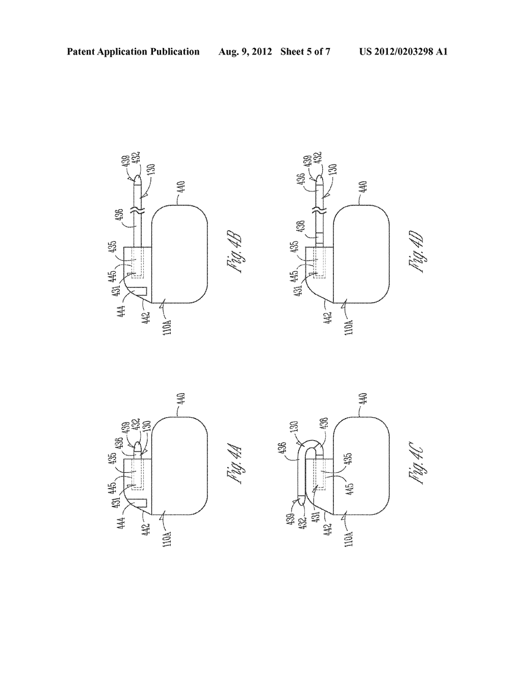 IMPLANTABLE CARDIAC MONITOR UPGRADEABLE TO PACEMAKER OR CARDIAC     RESYNCHRONIZATION DEVICE - diagram, schematic, and image 06