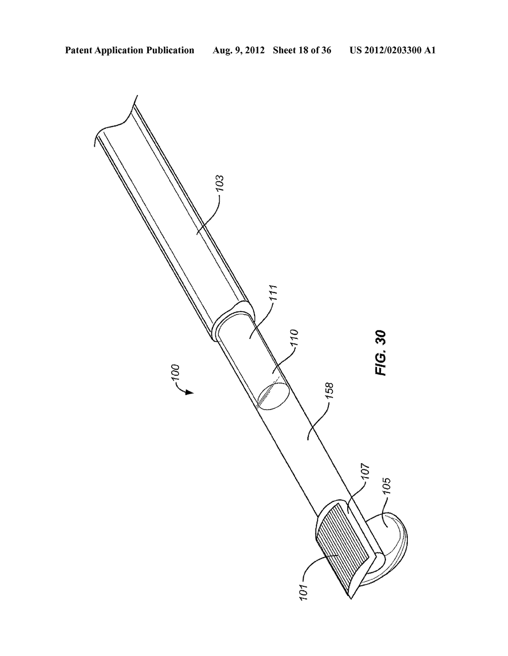 Method and Apparatus for Ablation of Benign, Pre-Cancerous and Early     Cancerous Lesions That Originate Within the Epithelium and are Limited to     the Mucosal Layer of the Gastrointestinal Tract - diagram, schematic, and image 19