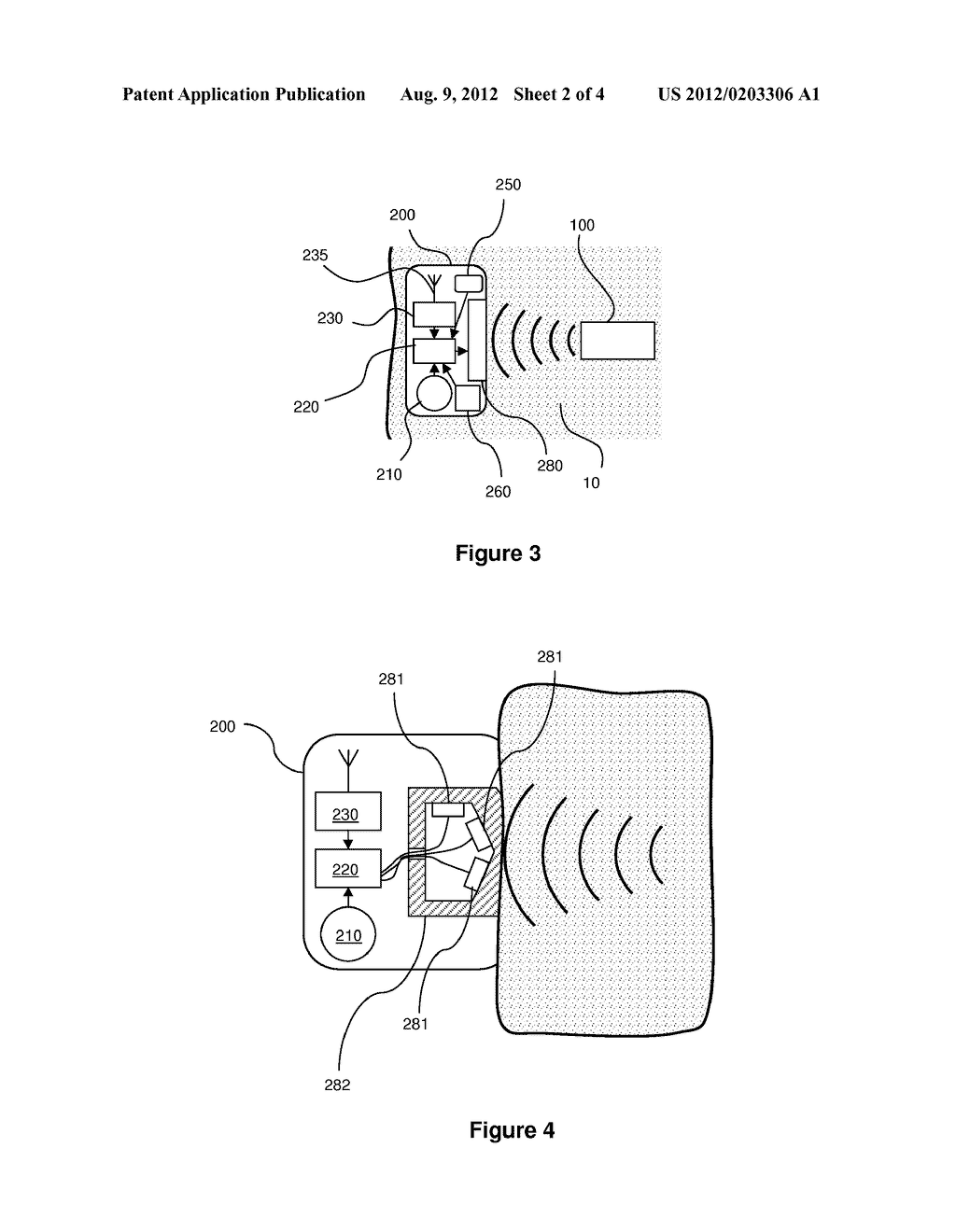 SYSTEMS FOR REMOTE GENERATION OF ELECTRICAL SIGNAL IN TISSUE BASED ON     TIME-REVERSAL ACOUSTICS - diagram, schematic, and image 03