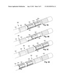 LEADS WITH SEGMENTED ELECTRODES FOR ELECTRICAL STIMULATION OF PLANAR     REGIONS AND METHODS OF MAKING AND USING diagram and image