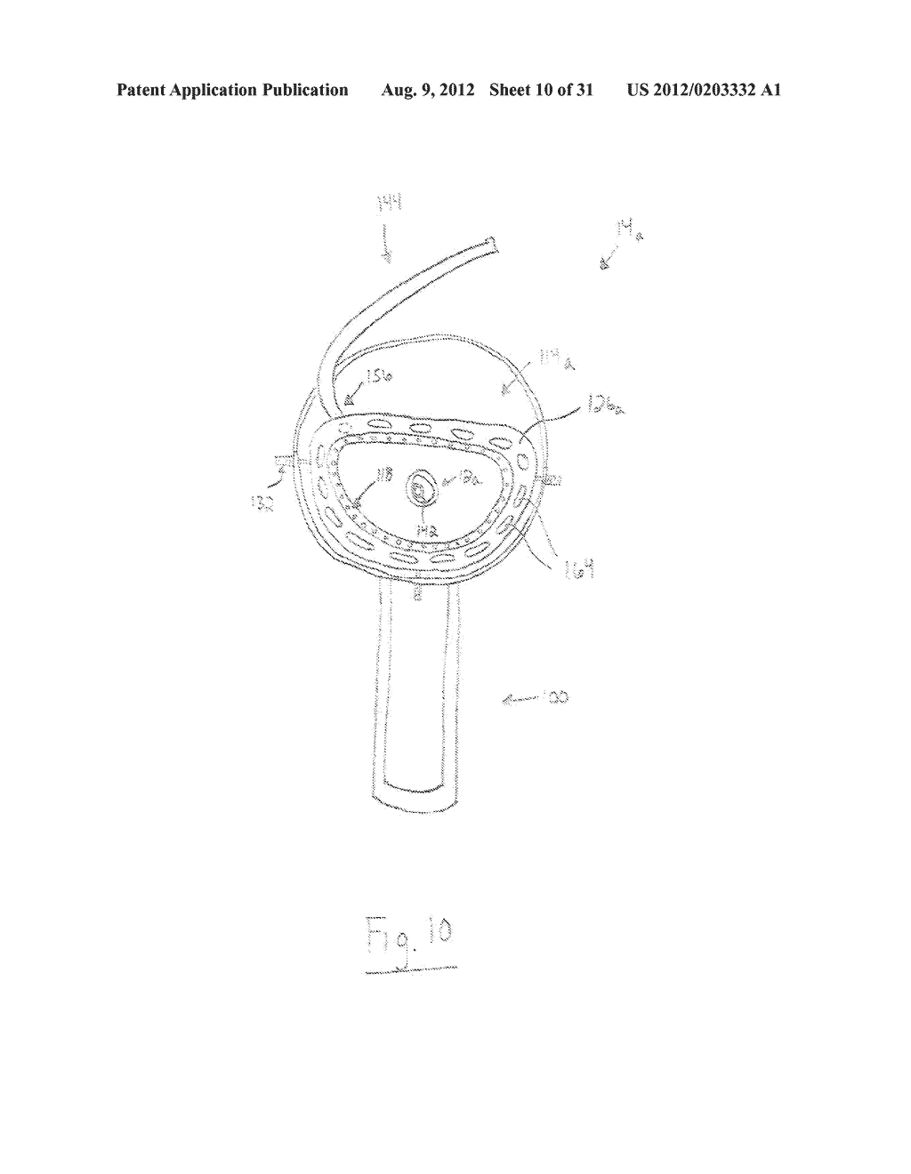 APPARATUS AND METHOD FOR DELIVERING AN IMPLANTABLE MEDICAL DEVICE TO A     DISEASED CARDIAC VALVE - diagram, schematic, and image 11