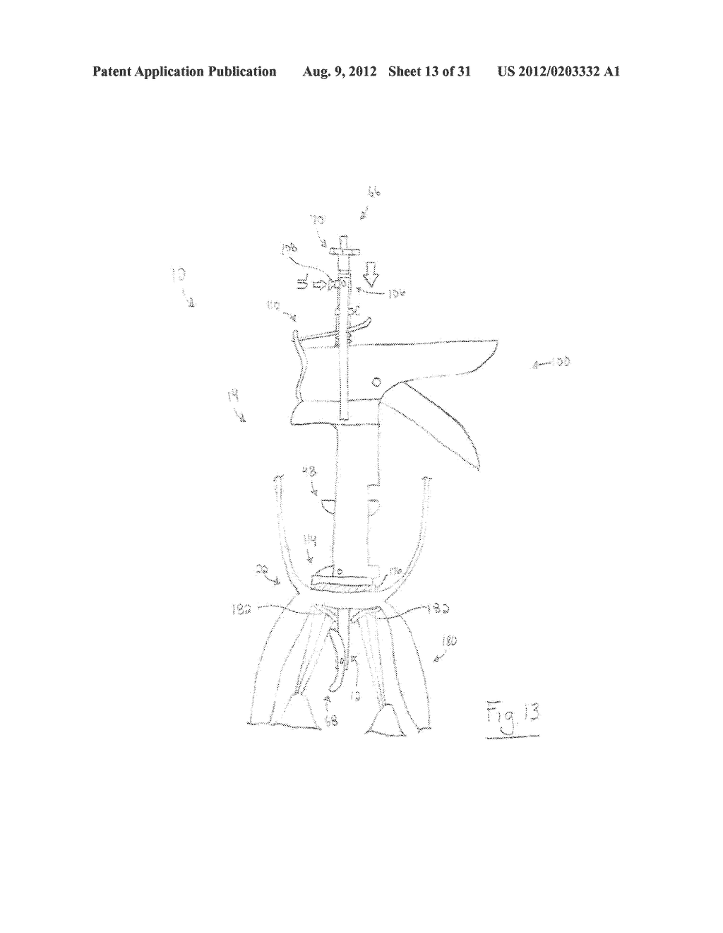 APPARATUS AND METHOD FOR DELIVERING AN IMPLANTABLE MEDICAL DEVICE TO A     DISEASED CARDIAC VALVE - diagram, schematic, and image 14