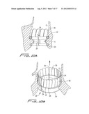 PERCUTANEOUS AORTIC VALVE diagram and image