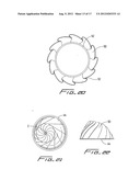 PERCUTANEOUS AORTIC VALVE diagram and image