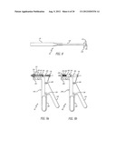 Leaflet Valve diagram and image