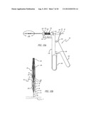 Leaflet Valve diagram and image