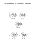 Leaflet Valve diagram and image