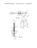 Leaflet Valve diagram and image