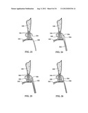 DEVICE AND METHOD FOR TEMPORARY OR PERMANENT SUSPENSION OF AN IMPLANTABLE     SCAFFOLDING CONTAINING AN ORIFICE FOR PLACEMENT OF A PROSTHETIC OR     BIO-PROSTHETIC VALVE diagram and image