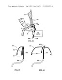 DEVICE AND METHOD FOR TEMPORARY OR PERMANENT SUSPENSION OF AN IMPLANTABLE     SCAFFOLDING CONTAINING AN ORIFICE FOR PLACEMENT OF A PROSTHETIC OR     BIO-PROSTHETIC VALVE diagram and image