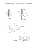 DEVICE AND METHOD FOR TEMPORARY OR PERMANENT SUSPENSION OF AN IMPLANTABLE     SCAFFOLDING CONTAINING AN ORIFICE FOR PLACEMENT OF A PROSTHETIC OR     BIO-PROSTHETIC VALVE diagram and image