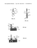 DEVICE AND METHOD FOR TEMPORARY OR PERMANENT SUSPENSION OF AN IMPLANTABLE     SCAFFOLDING CONTAINING AN ORIFICE FOR PLACEMENT OF A PROSTHETIC OR     BIO-PROSTHETIC VALVE diagram and image