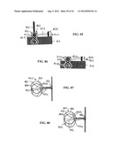 DEVICE AND METHOD FOR TEMPORARY OR PERMANENT SUSPENSION OF AN IMPLANTABLE     SCAFFOLDING CONTAINING AN ORIFICE FOR PLACEMENT OF A PROSTHETIC OR     BIO-PROSTHETIC VALVE diagram and image