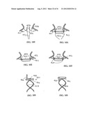 DEVICE AND METHOD FOR TEMPORARY OR PERMANENT SUSPENSION OF AN IMPLANTABLE     SCAFFOLDING CONTAINING AN ORIFICE FOR PLACEMENT OF A PROSTHETIC OR     BIO-PROSTHETIC VALVE diagram and image