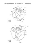 INTRAOCULAR IMPLANT diagram and image