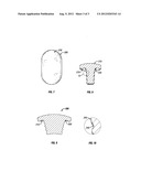 METHODS OF ARTICULAR CARTILAGE IMPLANTS diagram and image