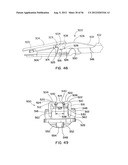 SYSTEM AND METHODS FOR INSERTING A SPINAL DISC DEVICE INTO AN     INTERVERTEBRAL SPACE diagram and image