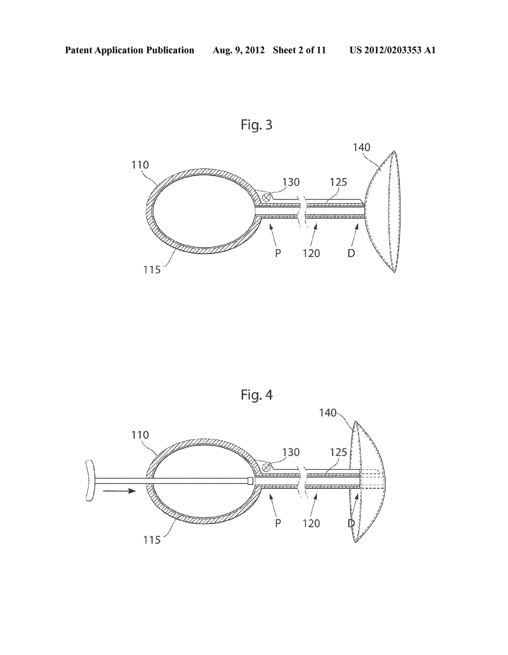 APPARATUS AND METHODS FOR TREATMENT OF ARTHROSIS OR OSTEOARTHRITIS IN A     JOINT OF A MAMMAL OR HUMAN PATIENT - diagram, schematic, and image 04