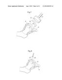 APPARATUS AND METHODS FOR TREATMENT OF ARTHROSIS OR OSTEOARTHRITIS IN A     JOINT OF A MAMMAL OR HUMAN PATIENT diagram and image