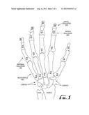 ANTI-ROLL GLOVES AND METHODS OF MANUFACTURE diagram and image