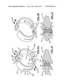 Opposed-Piston, Opposed-Cylinder Engine With Collinear Cylinders diagram and image