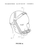 BREATHING ASSISTANCE APPARATUS diagram and image