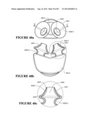 BREATHING ASSISTANCE APPARATUS diagram and image