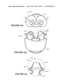 BREATHING ASSISTANCE APPARATUS diagram and image