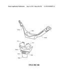 BREATHING ASSISTANCE APPARATUS diagram and image