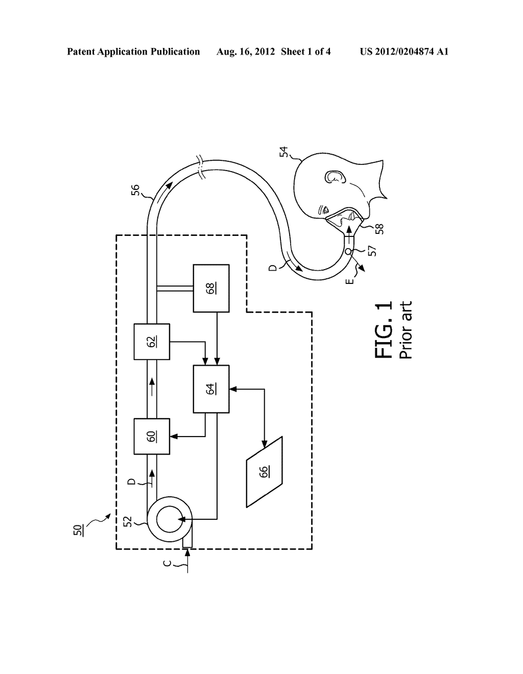 PRESSURE SUPPORT SUSTEM WITH INDUCTIVE TUBING - diagram, schematic, and image 02