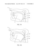 TONGUE RETENTION SYSTEM diagram and image