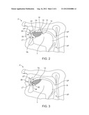 TONGUE RETENTION SYSTEM diagram and image