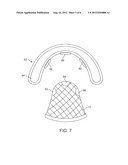 TONGUE RETENTION SYSTEM diagram and image