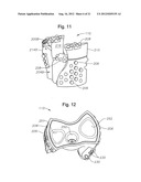 METHODS OF USING A PARTICLE IMPACT DRILLING SYSTEM FOR REMOVING     NEAR-BOREHOLE DAMAGE, MILLING OBJECTS IN A WELLBORE, UNDER REAMING,     CORING, PERFORATING, ASSISTING ANNULAR FLOW, AND ASSOCIATED METHODS diagram and image