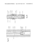 METHODS OF USING A PARTICLE IMPACT DRILLING SYSTEM FOR REMOVING     NEAR-BOREHOLE DAMAGE, MILLING OBJECTS IN A WELLBORE, UNDER REAMING,     CORING, PERFORATING, ASSISTING ANNULAR FLOW, AND ASSOCIATED METHODS diagram and image