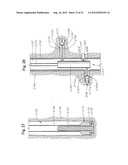 METHODS OF USING A PARTICLE IMPACT DRILLING SYSTEM FOR REMOVING     NEAR-BOREHOLE DAMAGE, MILLING OBJECTS IN A WELLBORE, UNDER REAMING,     CORING, PERFORATING, ASSISTING ANNULAR FLOW, AND ASSOCIATED METHODS diagram and image