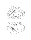 MULTI-LAYERED BLOOD COMPONENT EXCHANGE DEVICES, SYSTEMS, AND METHODS diagram and image