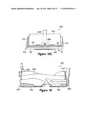 Double Strap Carrying System and Base Stand for Golf Bags and Other     Shoulder-Borne Articles diagram and image