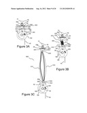 RETRACTING LIFELINE SYSTEMS FOR USE IN TIE-BACK ANCHORING diagram and image