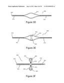 RETRACTING LIFELINE SYSTEMS FOR USE IN TIE-BACK ANCHORING diagram and image