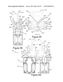 RETRACTING LIFELINE SYSTEMS FOR USE IN TIE-BACK ANCHORING diagram and image