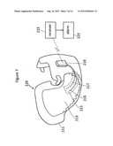 Disposable diaper with wireless alarm system diagram and image