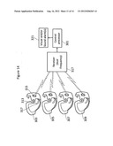 Disposable diaper with wireless alarm system diagram and image